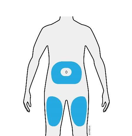 Figura stilizzata del corpo umano con evidenziate in blu le aree di iniezione: glutei e cosce