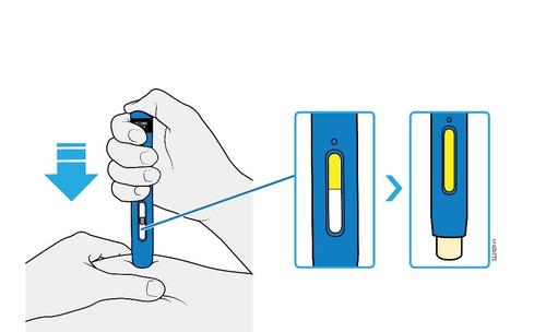 Mano che tiene un dispositivo blu per iniezione con freccia blu indicante la pressione e schema del meccanismo interno