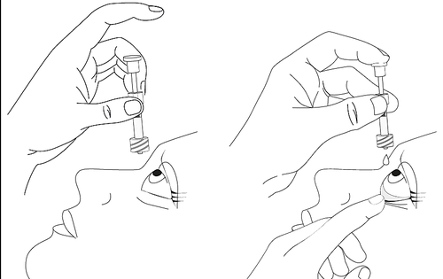 Due mani che tengono una siringa preriempita e un ago, mostrando la tecnica di iniezione sottocutanea con un pizzicamento della pelle