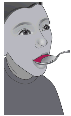 Bambino con la bocca aperta che riceve un cucchiaino contenente un liquido rosso dalla somministrazione orale