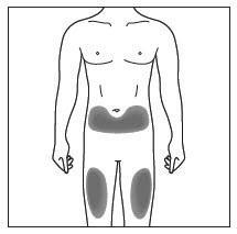 Schema del corpo umano con aree ombreggiate che indicano i siti di iniezione nell