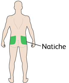 Figura schematica di una persona vista da dietro con evidenziate in verde le aree dei glutei indicate con la scritta
