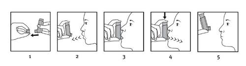 Sequenza di cinque disegni che mostrano l