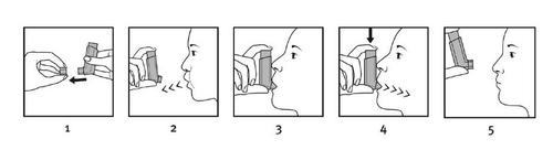 Sequenza di cinque disegni che mostrano l