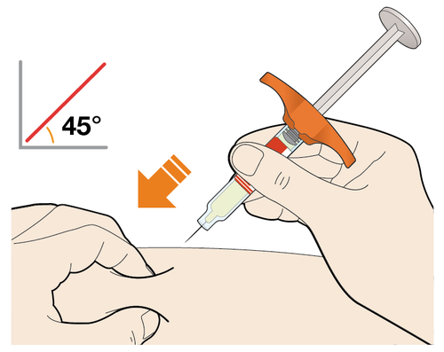 Mano che tiene una siringa preriempita con ago inserito nella pelle ad angolo di 45 gradi freccia indica la direzione dell