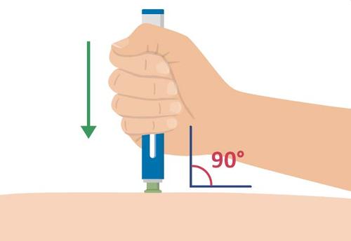 Mano che tiene una penna per iniezione con ago inserito nella pelle ad angolo retto indicato da 90 gradi freccia verde verso il basso