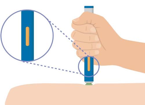 Mano che tiene un dispositivo blu per iniezione sottocutanea con ago inserito nella pelle e dettaglio ingrandito dell