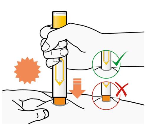Mano che tiene un dispositivo autoiniettante arancione e bianco con freccia verso il basso e pelle sottostante con indicazioni di corretto e scorretto utilizzo
