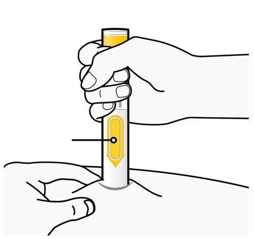 Mano che stringe un dispositivo per iniezione con ago rivolto verso la pelle dell