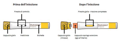 Penna precompilata DUPIXENT con cappuccio giallo e arancione prima e dopo l