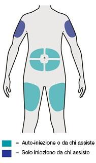 Schiena umana con aree evidenziate in azzurro per auto-iniezione o assistenza e in blu per iniezione assistita