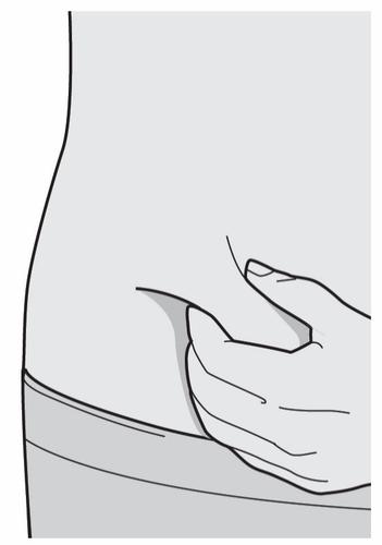 Mano che solleva una piega di pelle, pronta per un&rsquo;iniezione sottocutanea nella parte superiore della coscia