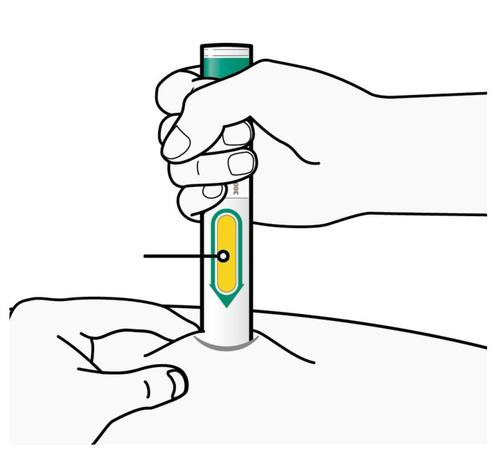 Mano che tiene un dispositivo per iniezione sottocutanea con ago inserito nella pelle dell