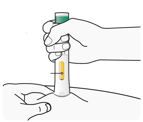 Mano che afferra un dispositivo penna per iniezione con area gialla evidenziata e puntata verso la pelle del braccio