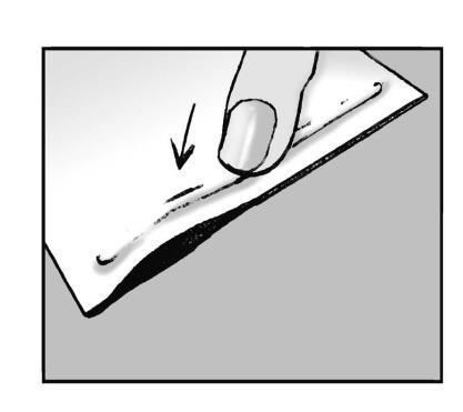 Mano che preme un cerotto adesivo trasparente su una ferita lineare sulla pelle chiara con una freccia nera indicante la direzione