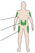 Schema del corpo umano con aree evidenziate in verde per iniezioni sottocutanee su braccia, fianchi e cosce
