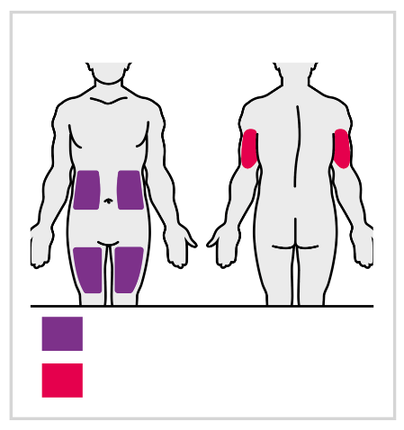 Due figure umane stilizzate mostrano aree di iniezione evidenziate in viola e rosa su fianchi, cosce e braccia