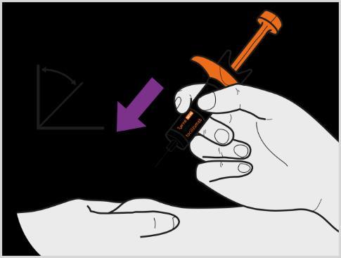 Mano che tiene una siringa preriempita con ago inserito nella pelle ad angolo di 45 gradi freccia viola indica direzione iniezione