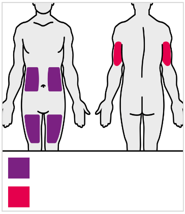 Corpo umano frontale e dorsale con aree colorate in viola e rosa che indicano possibili siti di iniezione intramuscolare