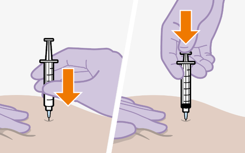 Mano guantata viola che tiene una siringa con ago rivolto verso il basso e freccia arancione indicante la direzione dell