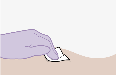 Mano con guanto viola che applica un tampone imbevuto sulla pelle beige chiara prima di un