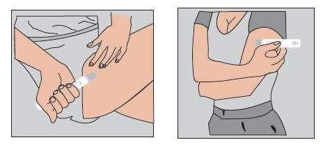 Mano che tiene una penna per iniezione e inietta il farmaco nel tessuto sottocutaneo del braccio piegato