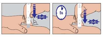 Iniezione sottocutanea con penna precompilata, freccia blu indica pressione e clic, angolo di 45 gradi, timer mostra 5 secondi