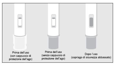 Tre siringhe preriempite mostrano lo stato prima e dopo l
