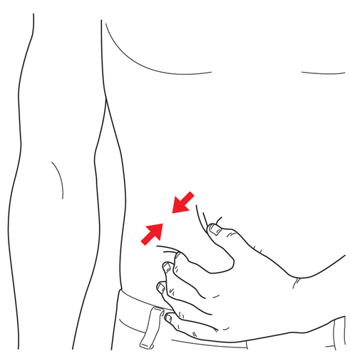 Mano che pizzica la pelle del gluteo con due dita mentre una freccia rossa indica il punto di iniezione sottocutanea