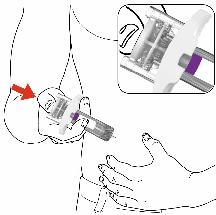 Iniezione sottocutanea con siringa pre-riempita, freccia rossa indica il punto di iniezione sulla coscia e dettaglio ingrandito della siringa