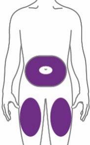 Corpo umano stilizzato con evidenziate in viola le aree di iniezione glutea e sovrapubica