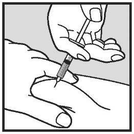 Mano che tiene una siringa inclinata che inietta un farmaco nella pelle del braccio con l