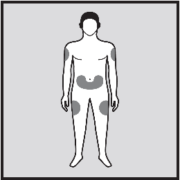 Schema corporeo umano con aree ombreggiate che indicano possibili siti di iniezione sottocutanea su braccia, fianchi e addome