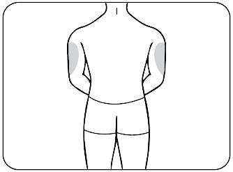 Schizzo della schiena umana con aree ombreggiate che indicano i possibili siti di iniezione intramuscolare sui glutei