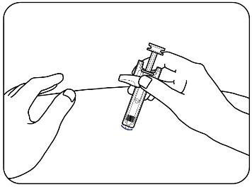 Mano che tiene una penna per iniezione con ago esposto e cartuccia trasparente parzialmente visibile