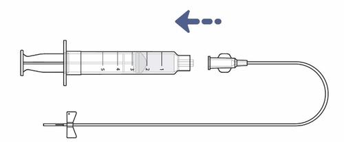 Siringa con ago separato e prolunga trasparente collegata, freccia blu indica direzione del flusso del farmaco