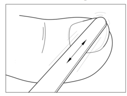 Iniezione sottocutanea con ago inserito ad angolo piatto nella piega cutanea del braccio