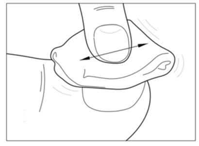 Dito che preme su un dispositivo autoiniettante con ago inserito nella piega cutanea per l