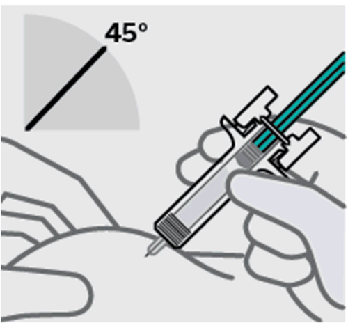 Mano che tiene una siringa preriempita inclinata a 45 gradi mentre l