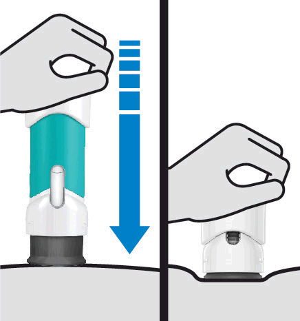 Dispositivo autoiniettante blu e bianco con ago esposto e freccia blu che indica la direzione di iniezione sulla pelle