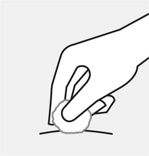 Mano che tampona con un batuffolo di cotone la zona di iniezione sulla pelle preparata per l