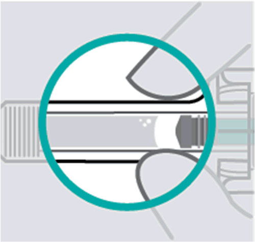 Siringa preriempita con stantuffo parzialmente spinto in avanti e ago collegato circondati da un cerchio azzurro
