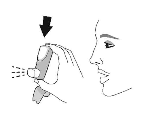 Profilo di una testa con spray nasale applicato da una mano, freccia nera indica la direzione del getto