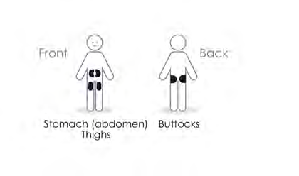 Due figure stilizzate mostrano le aree di iniezione addominale e glutea indicate con rettangoli neri su cosce e natiche