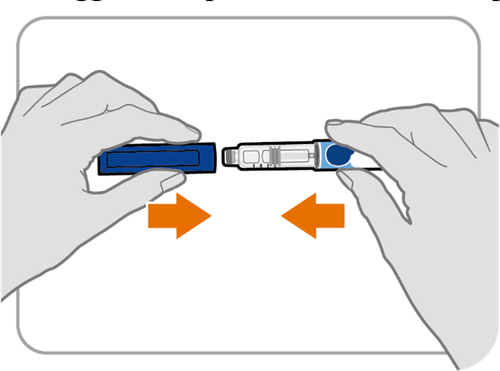 Due mani che assemblano un dispositivo medico blu con due componenti e frecce arancioni che indicano la direzione di connessione
