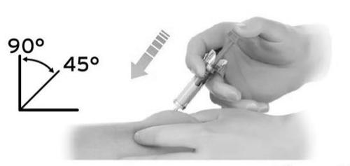 Mano che tiene una siringa inclinata a 45&deg; mentre inietta il farmaco nella pelle del braccio con un angolo indicato