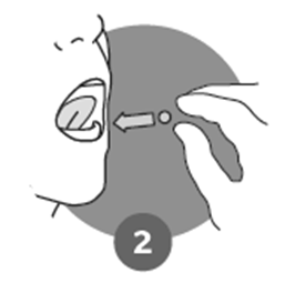 Profilo del viso con freccia che indica il punto di iniezione nell