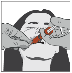 Mani che tengono un applicatore nasale rosso mentre il paziente inclina la testa leggermente indietro e apre la bocca