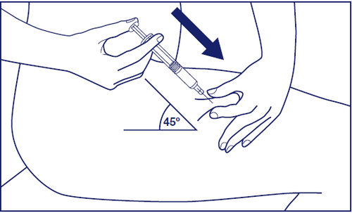 Mano che tiene una siringa inclinata a 45 gradi mentre inietta il farmaco nel braccio di un paziente con una freccia nera