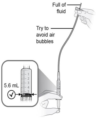 Siringa trasparente con liquido graduato 5,6 ml e ago, mano che la maneggia evitando bolle d